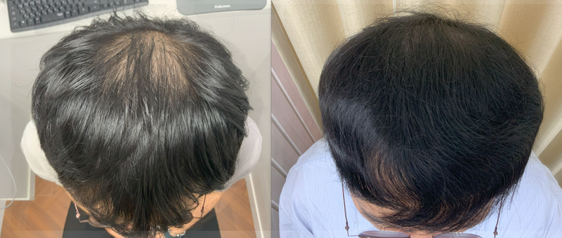 관리전후B&A1.PNG