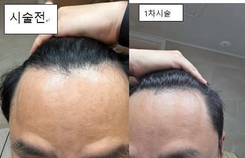 챕쳐5jpg.jpg