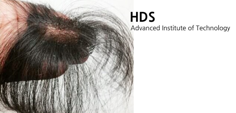 hairfiller-1100x530.jpg