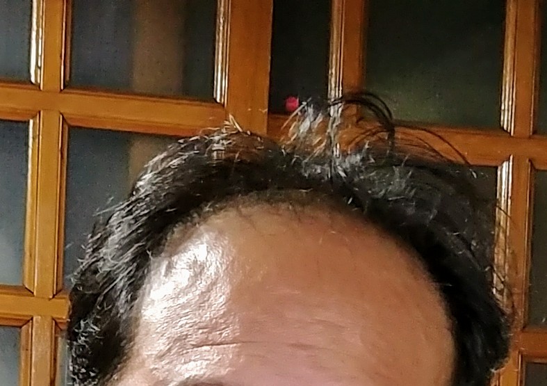 20170509_204458~2.jpg