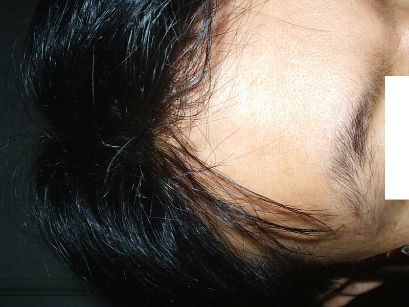 S2010017.JPG