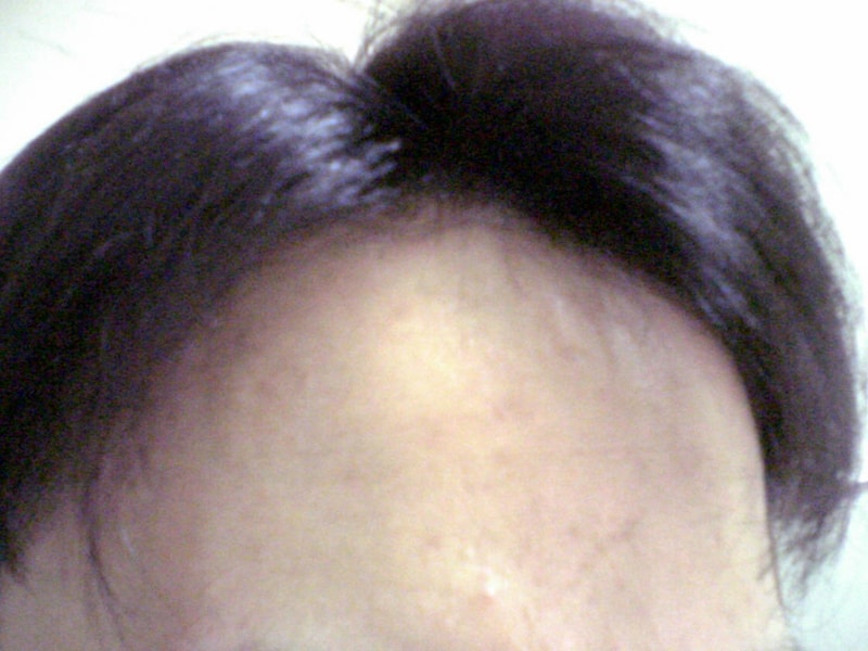 회전_mogenic (4).jpg