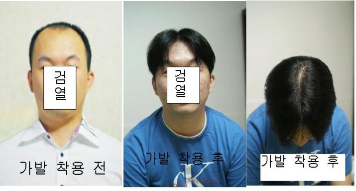 대머리 생활 5년 후 ...... 첫 가발 체험기
