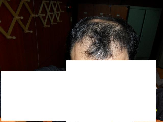 빠진것.JPG