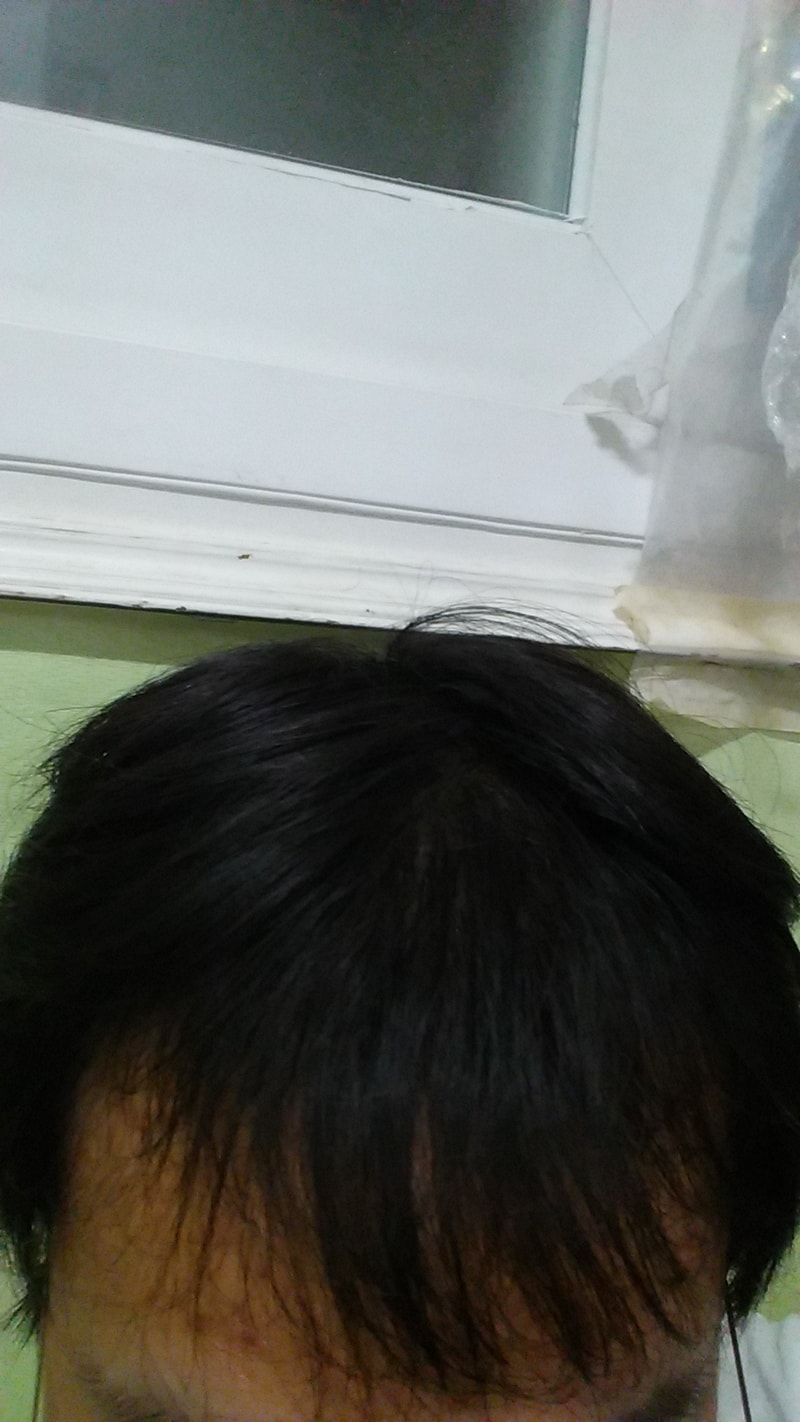 20161024_222628.jpg