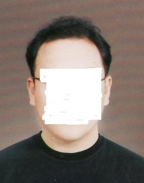 가발 쓸까 고민 중입니다.