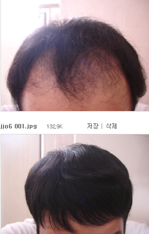 젊은 M 분들~! 이제 용기내서 우리 행복합시다~~