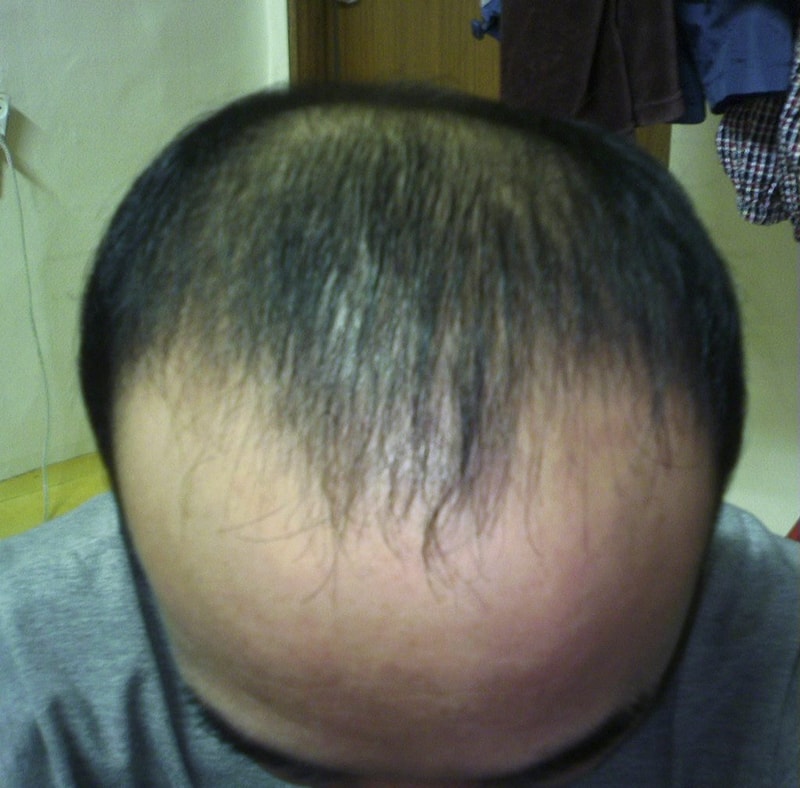 가발을 쓰려고 하는데 조언 부탁드립니다.