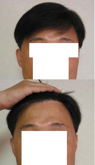 처음 가발 착용 했는데...
