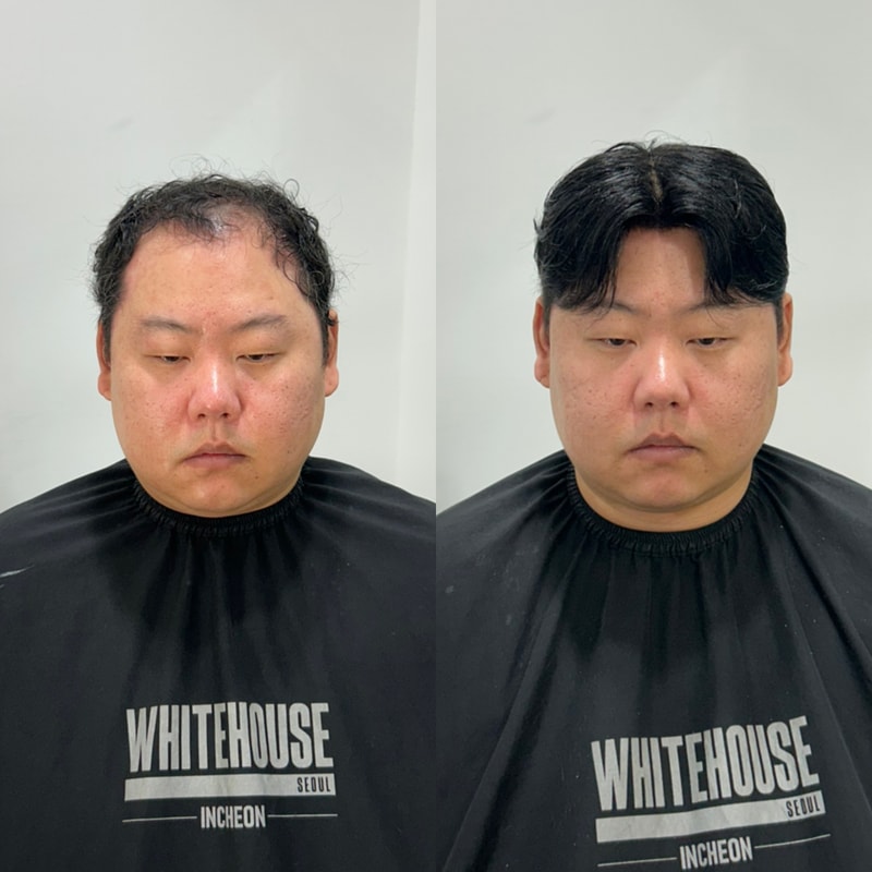 가르마 스타일 가발 후기  (화이트하우스 인천)