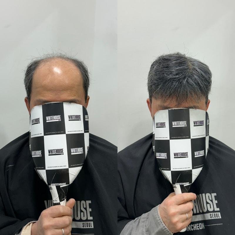 白色住宅仁川店白发假发选择标准