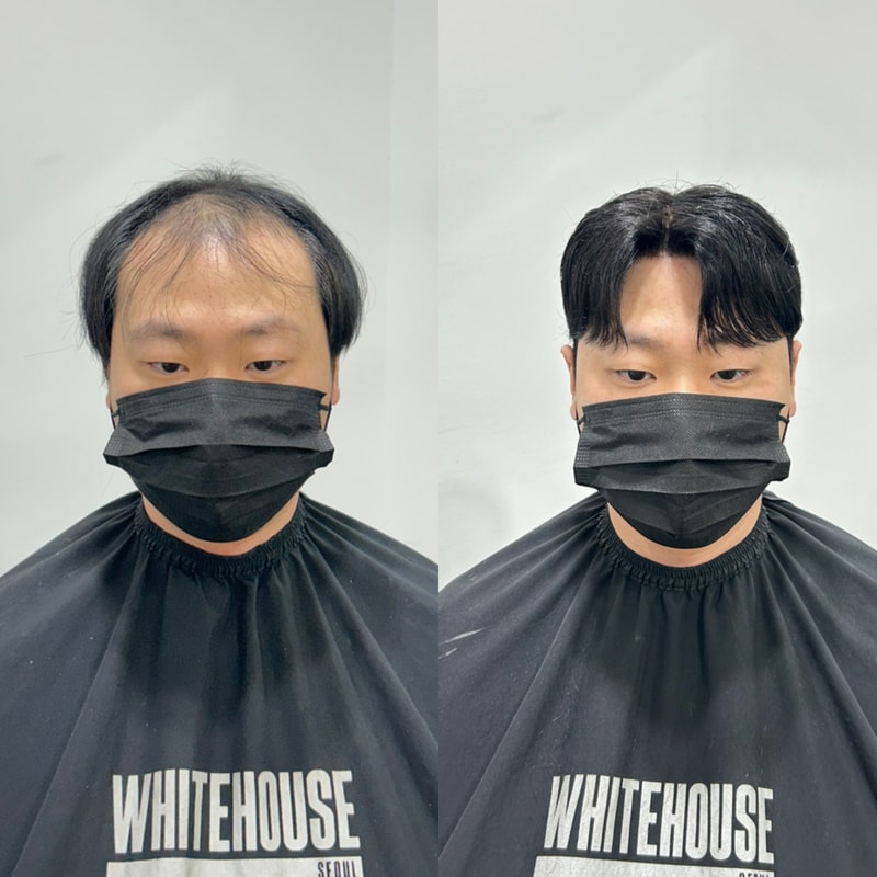 分头式假发制作后期白屋仁川直营店