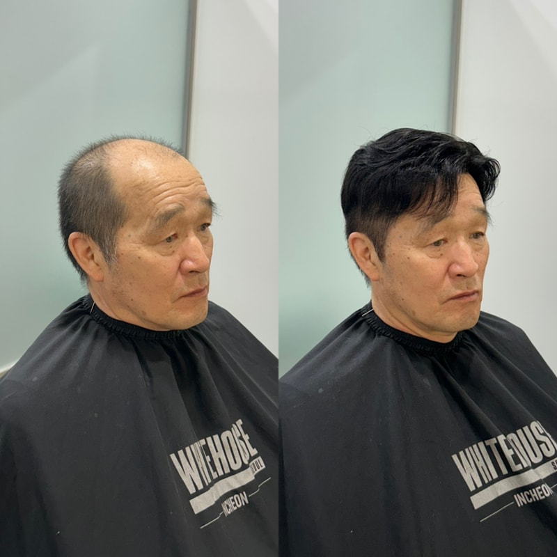 白色住宅仁川婚礼上父亲的假发流行且稳重的风格手术后记