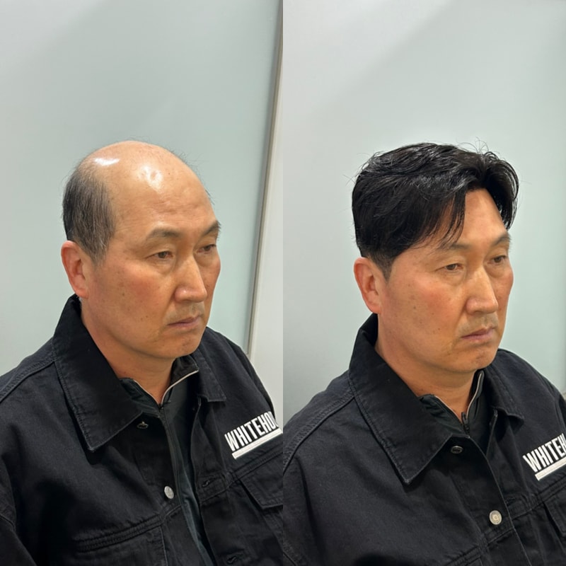 白色房子仁川胶带型中分风格