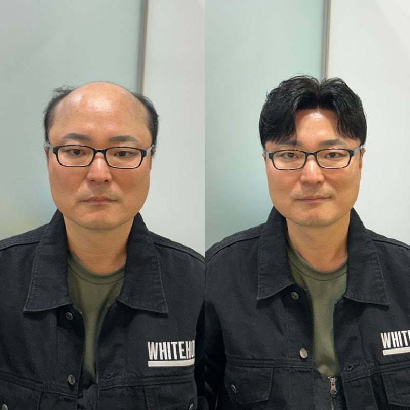 以局部假发完成的男友风格中分卷发式白屋仁川店