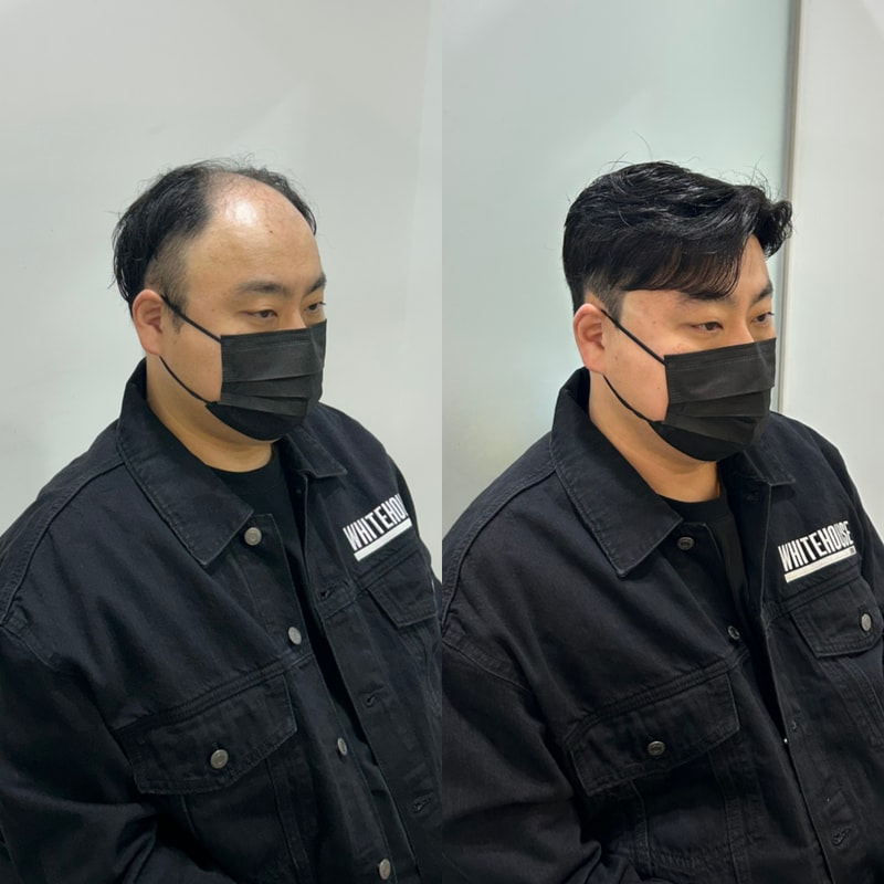 白色住宅仁川部分假发 + 头皮纹身，自然变身为gail风格的顾客