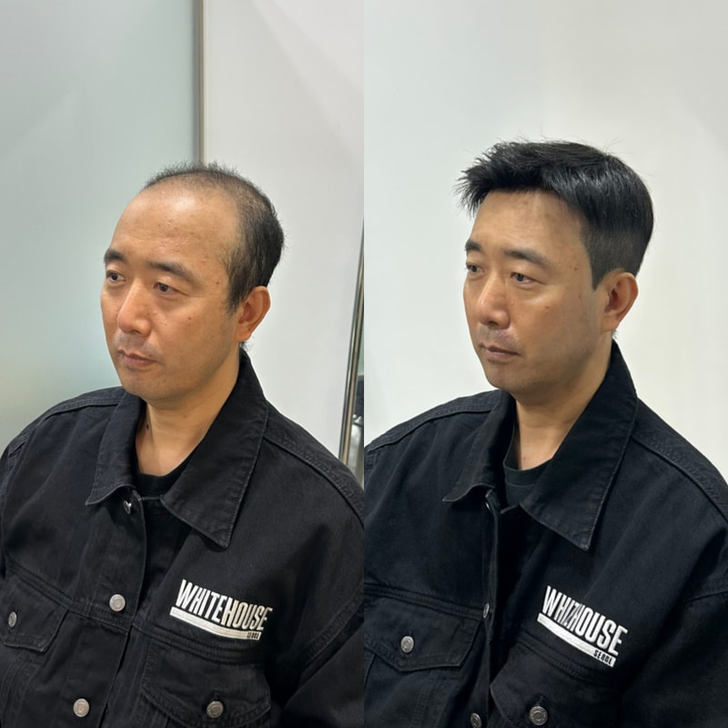 白色住宅仁川直营店旁边·后面是头皮纹身，上面是假发，自然地