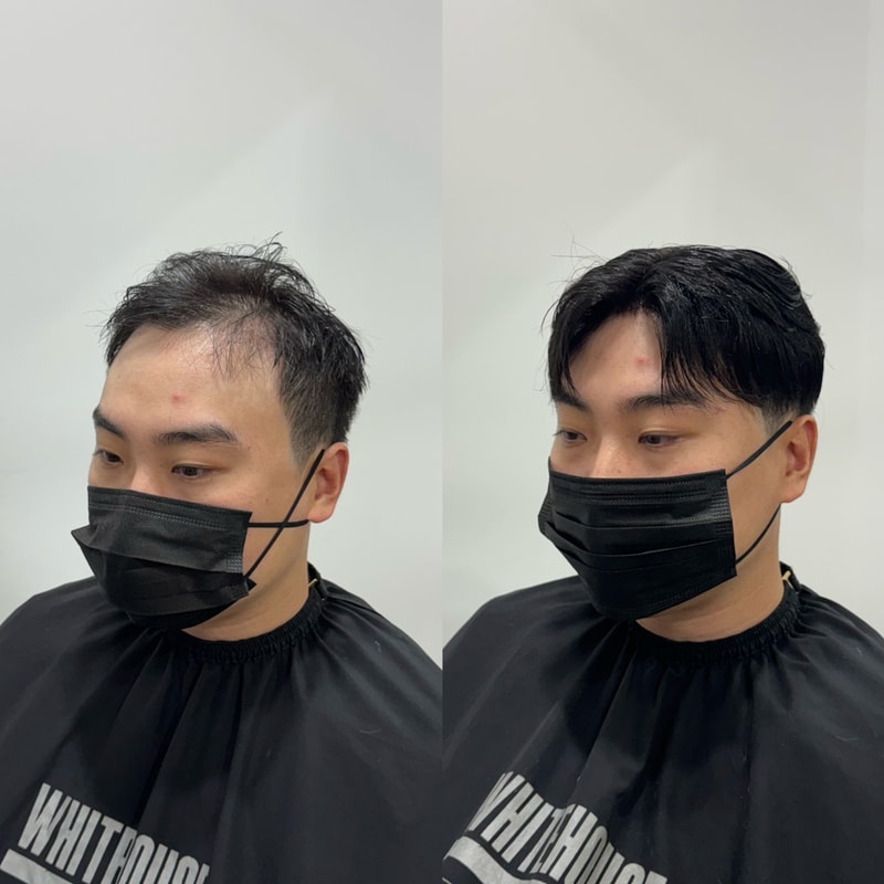 화이트하우스서울 인천직영점 대다모 보고 방문했는데 진짜 인생 바뀌었습니다