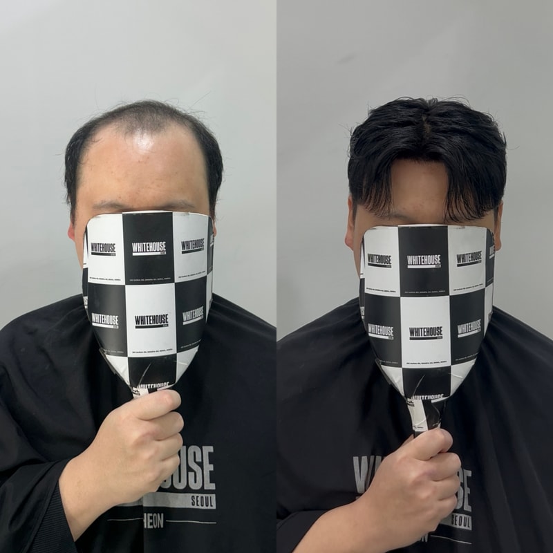 가르마 스타일 가발을 이렇게 자연스럽게 만들었습니다 화이트하우스인천직영점
