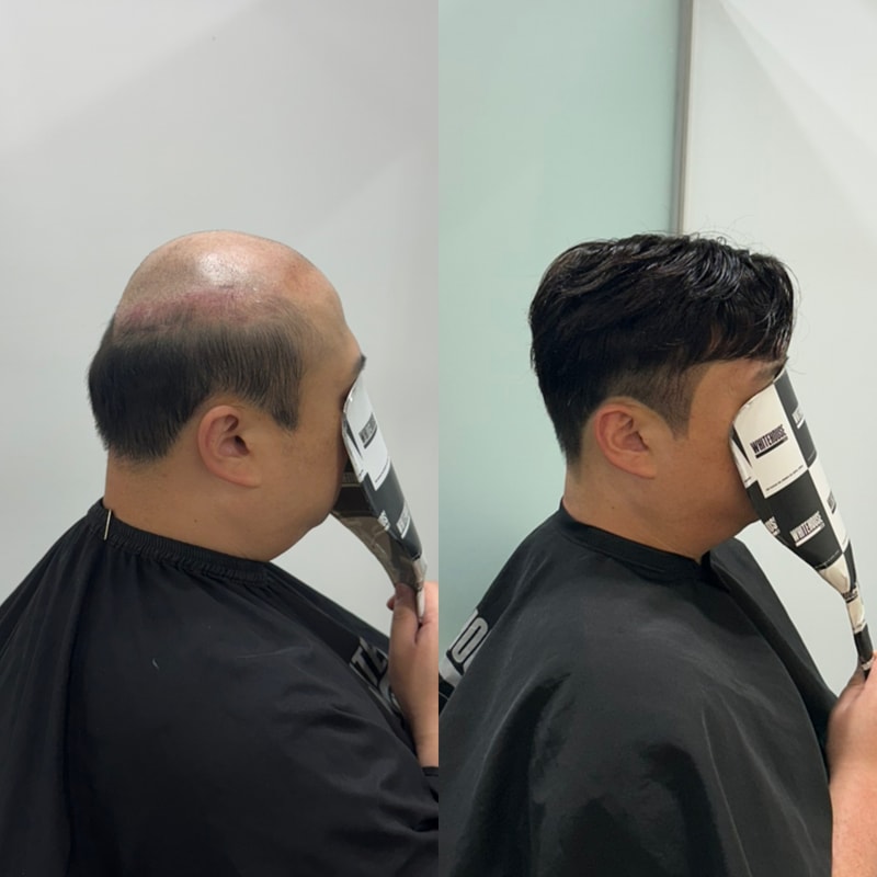 자연스러움을 찾기 위해 방문하신 고객님 | 화이트하우스 인천직영점