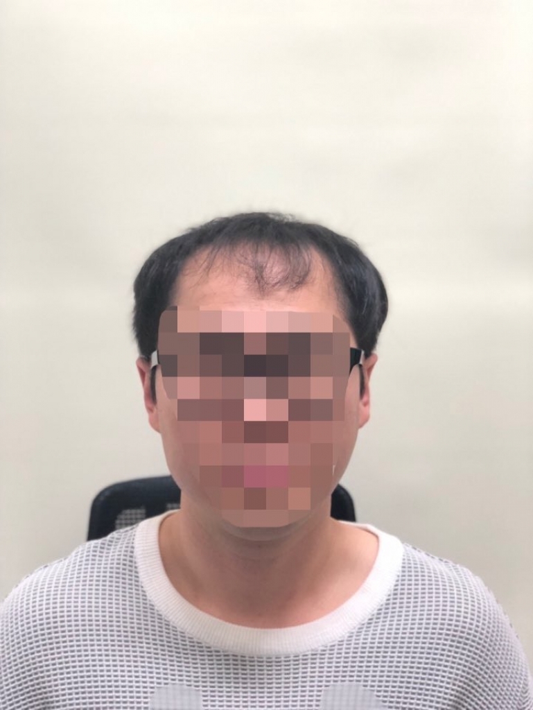 처음으로 가발마췄어요.