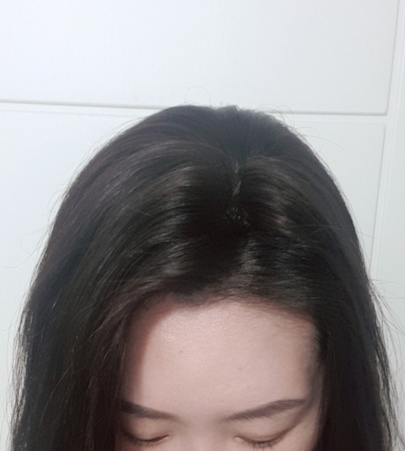 정수리 부분가발 후기