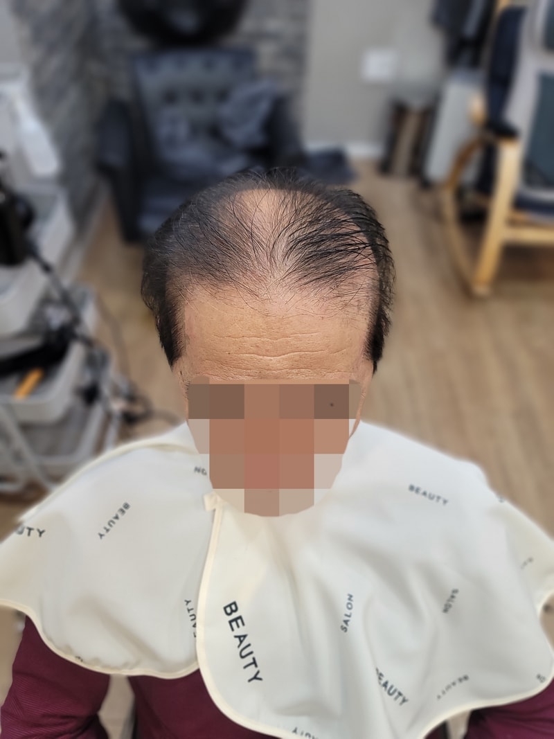 대구가발 모라인에서 60대착용후기