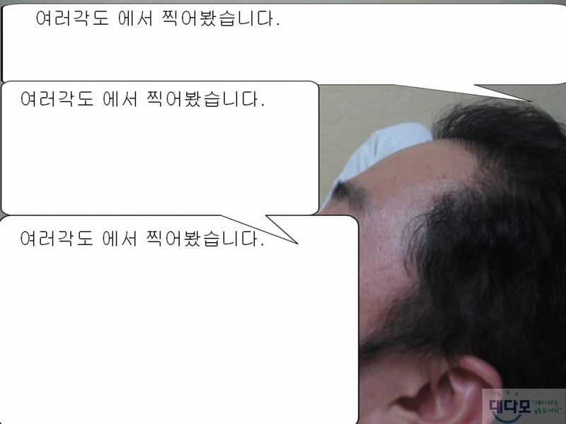 얼굴가리기7.jpg