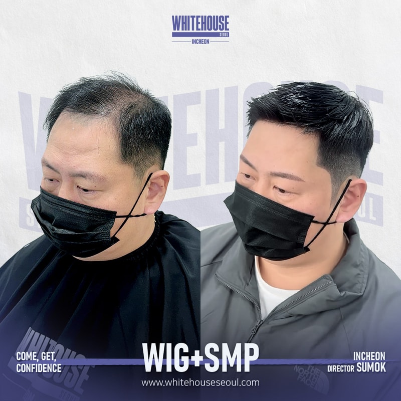 박찬희-옆위-[WIGSMP].jpeg