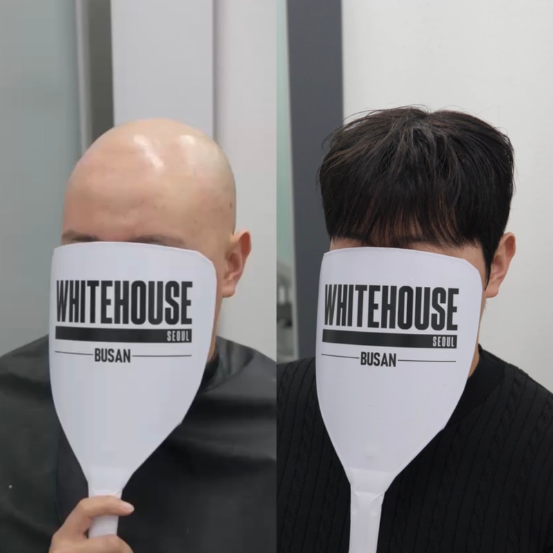 부산화이트하우스 맞춤가발 후기 