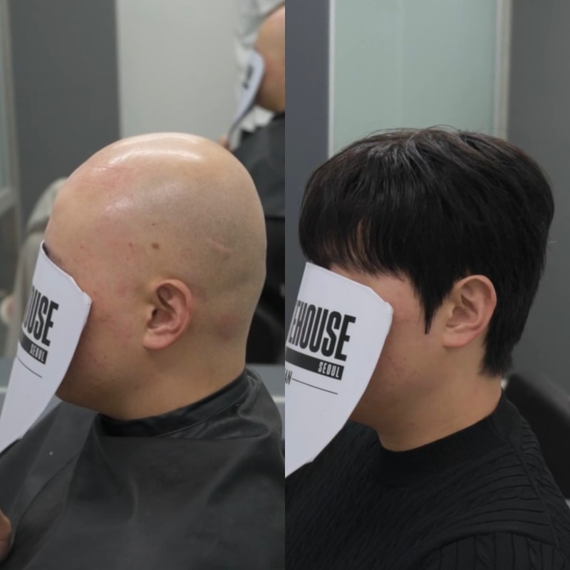 부산항암가발_2.jpeg