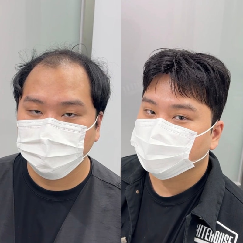 부산 맞춤가발, 짧은 헤어스타일도 자연스럽게