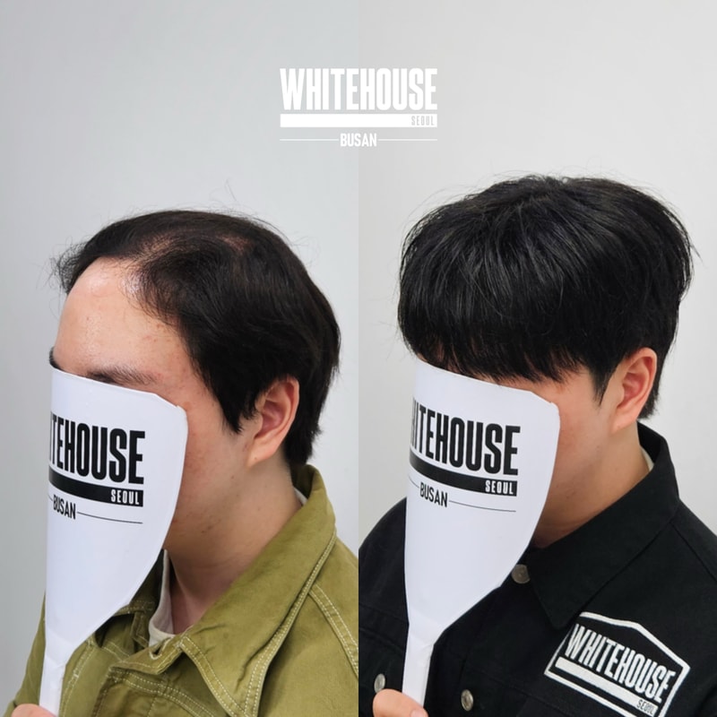 부산남자가발_화이트하우스부산.jpeg