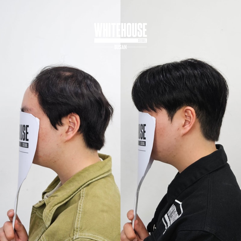 부산남자가발_화이트하우스부산성현_2.jpeg