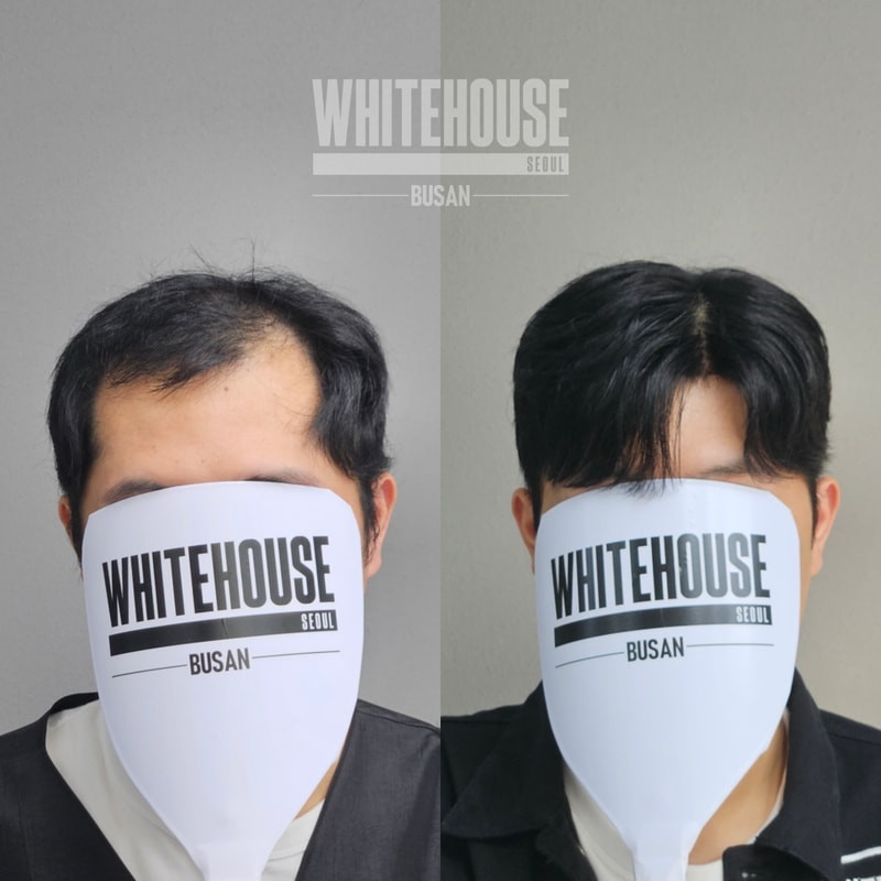 부산남자가발 화이트하우스부산 가르마스타일
