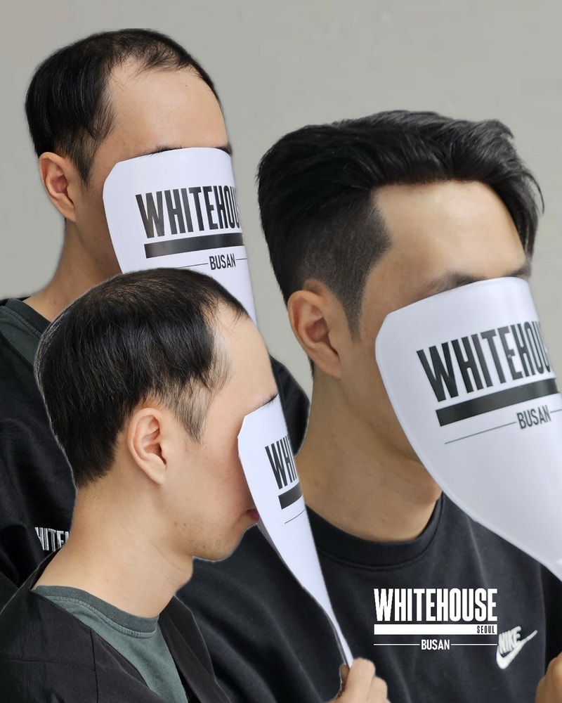 부산두피커버_가발.jpeg