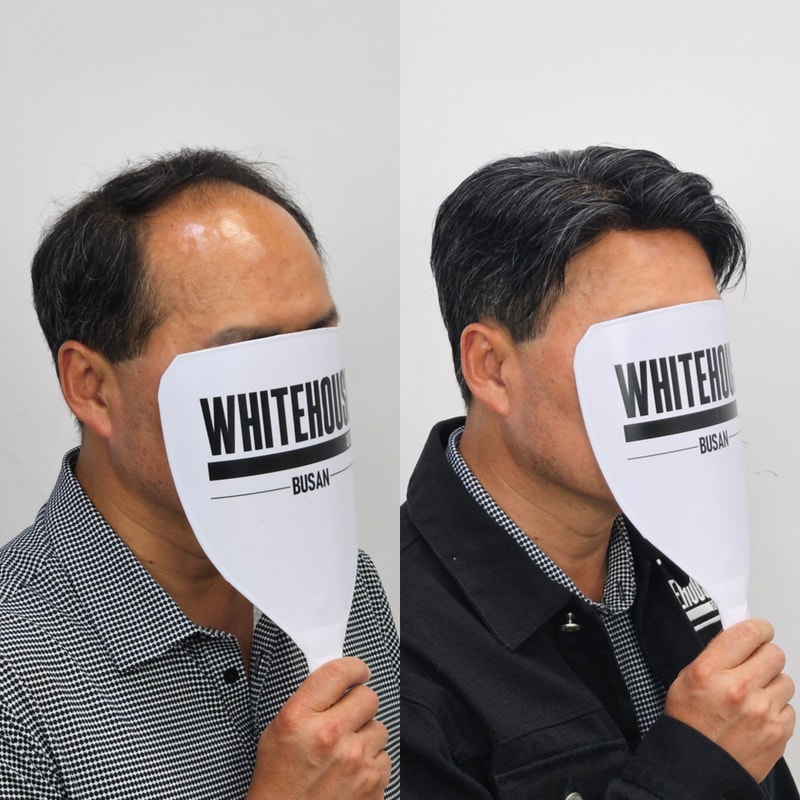  부산50대가발.jpeg