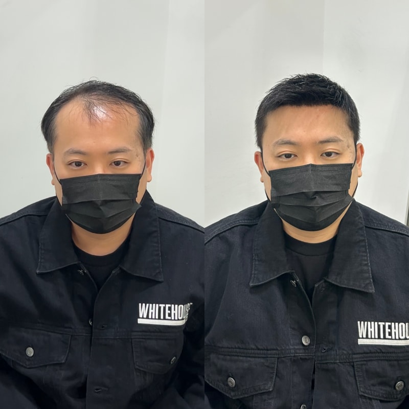 리젠트컷 자연스러움은 질감에서 이음새에서 차이가 납니다 화이트하우스인천
