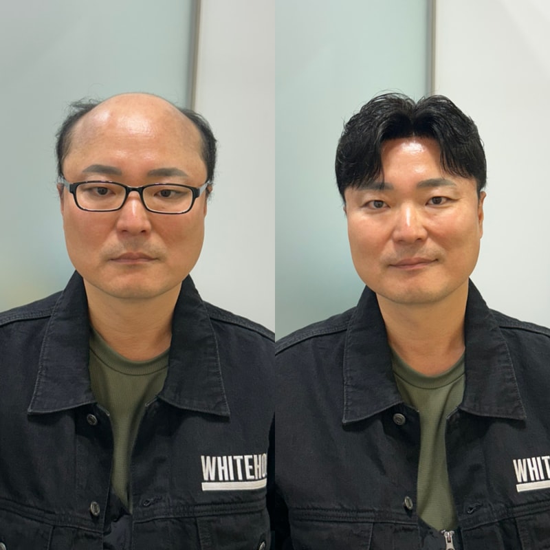 화이트하우스 인천    가르마스타일 가발 디자인하면서 가장 신경 쓰는 부분 