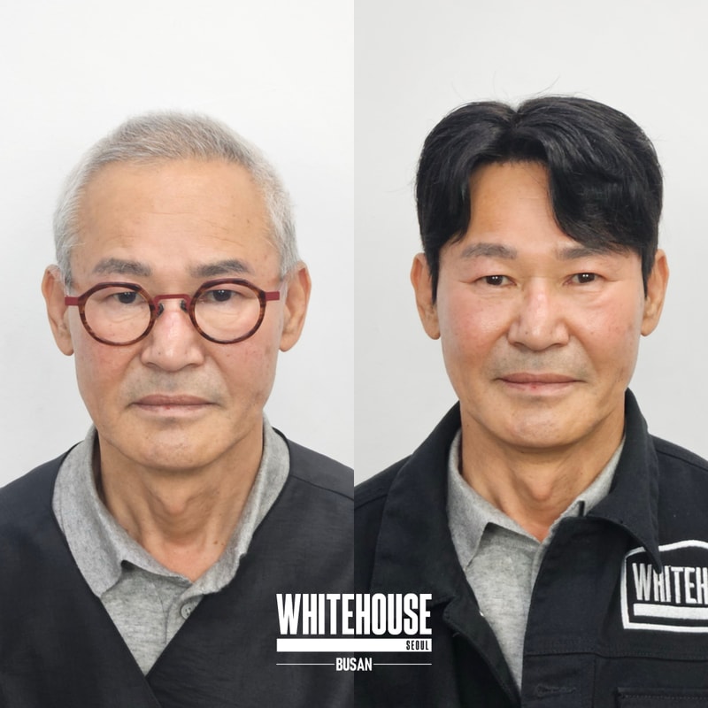 부산전체가발,항암가발 맞춤 제작