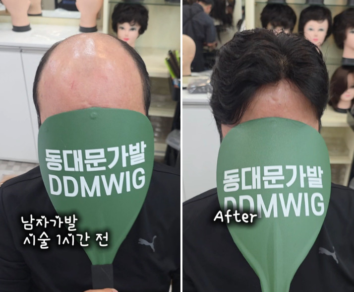 남자가발 언제든 툭툭 털어써도 되는 부분가발 (기성가발 2시간컷)