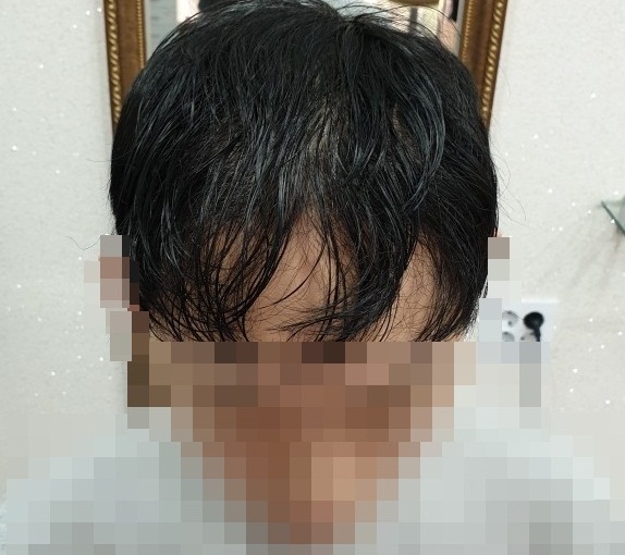 증모술 후기입니다.