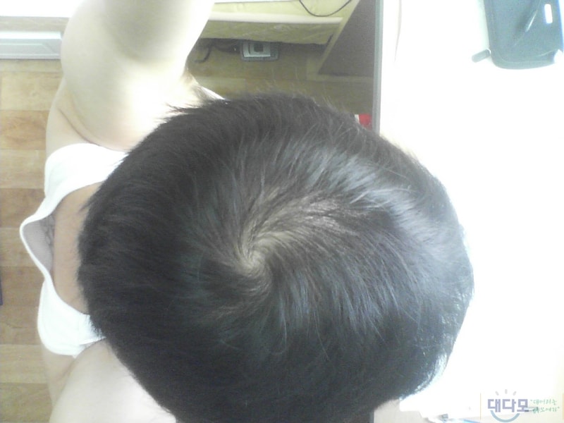 정수리.jpg