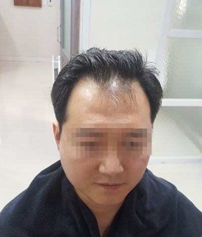 오늘 첫가발구매했습니다.(창원)