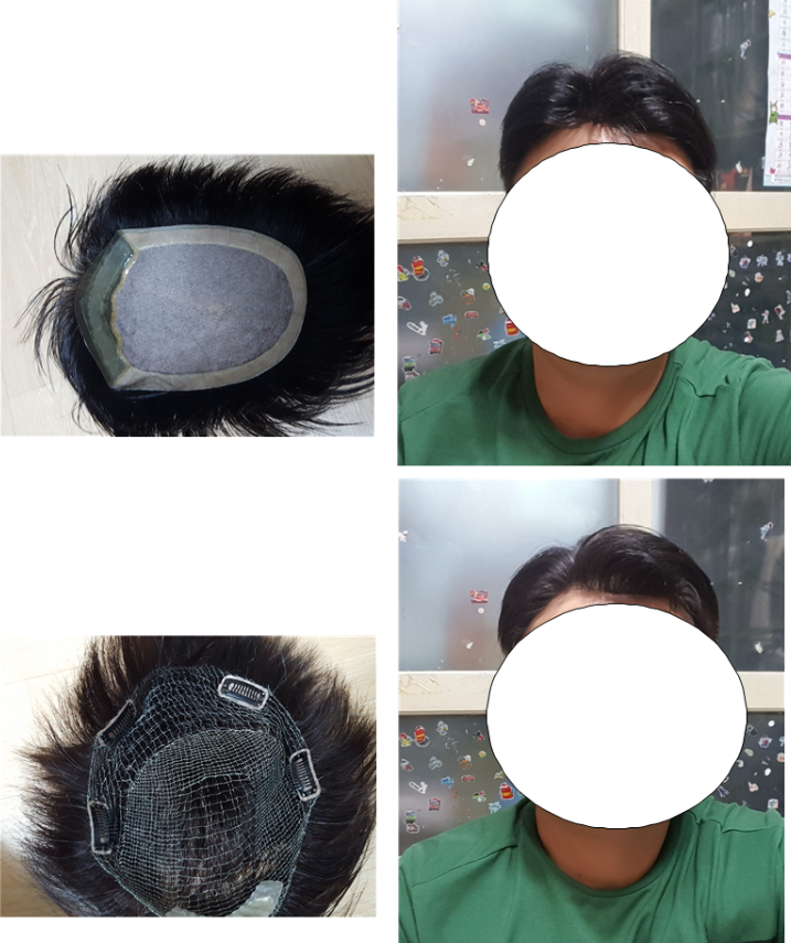 12년 가발쓰면서 가발 바꾸고 처음으로 올려봅니다.