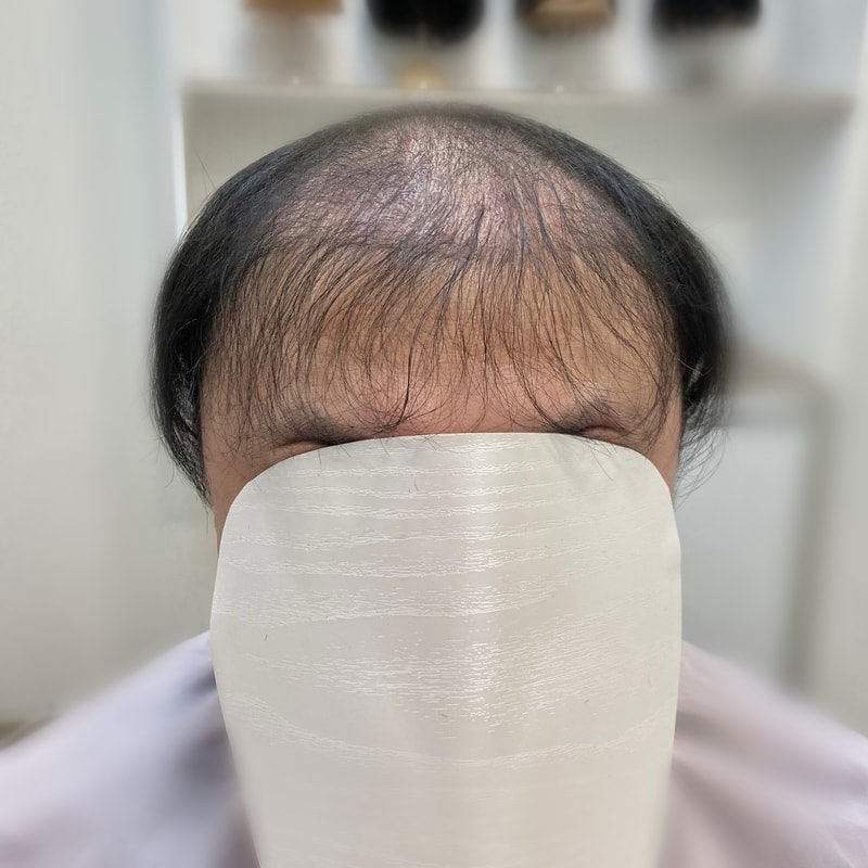 가발전후사진 홈페이지용 41.jpg