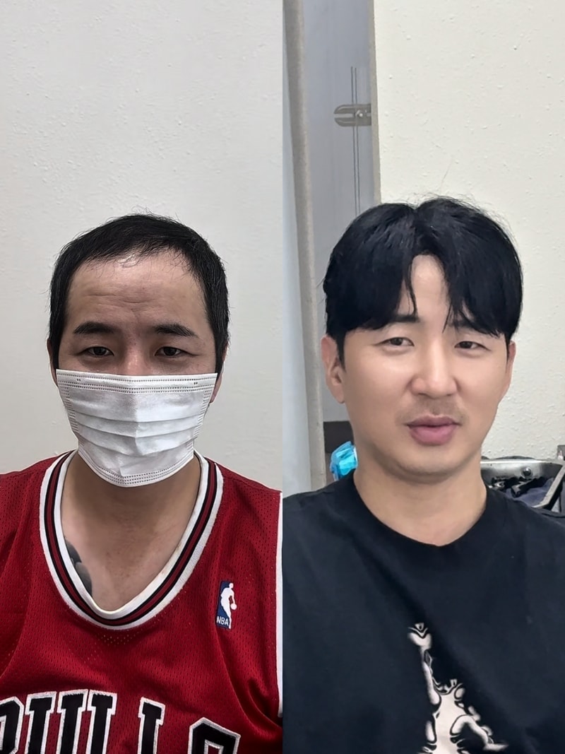 남자 가발 애즈펌