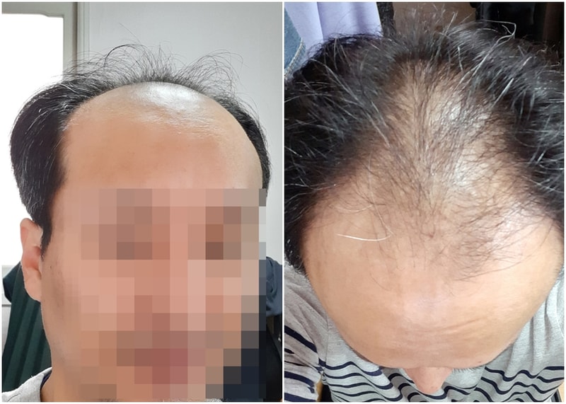 가발 구입 + 미용 = 얼마일까요?