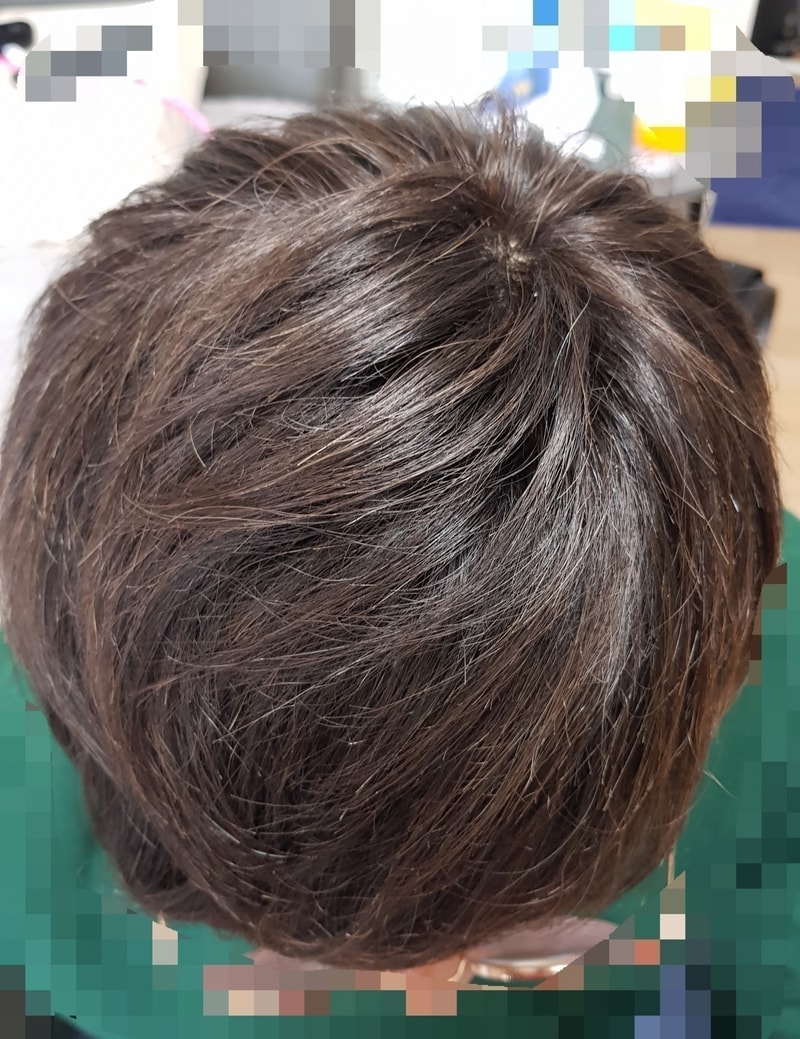 대다모 10년차 가발러