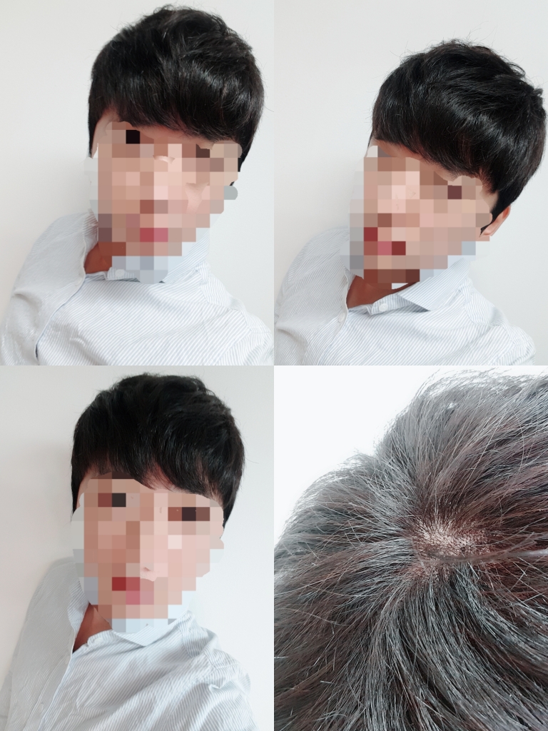 이거 가발 진즉 맞출걸그랬네요..ㅋㅋ